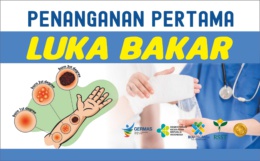 Penanganan Pertama Luka Bakar