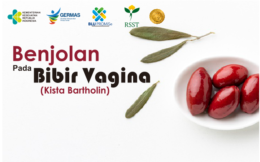 Benjolan Pada Bibir Vagina (Kista Bartholin)