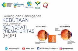 Skrining dan Pencegahan Kebutaan yang Disebabkan Retinopati Prematuritas (ROP)