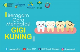Beragam Cara Mengatasi Gigi Kuning