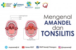 Mengenal Amandel atau Tonsillitis