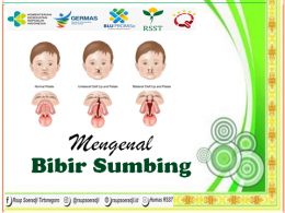 Mengenal Bibir Sumbing