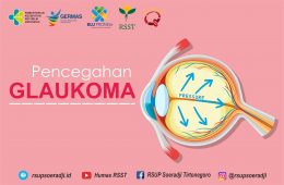 Pencegahan Glaukoma