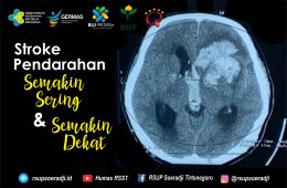 Stroke Perdarahan : Semakin Sering dan Semakin Dekat