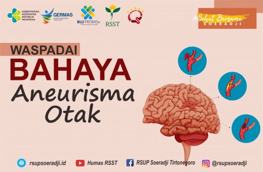 Waspadai Bahaya Aneurisma Otak