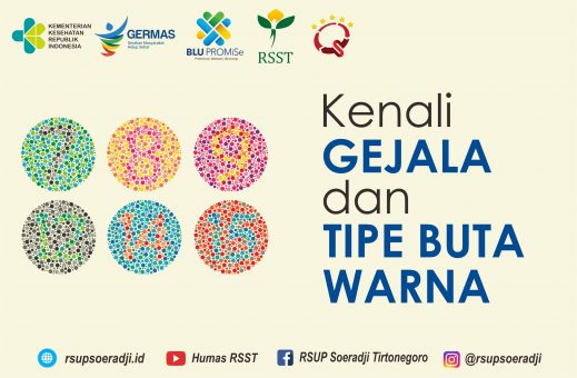 Kenali Gejala dan Tipe Buta Warna