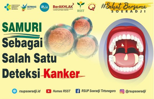 SAMURI Sebagai Salah Satu Deteksi Dini Kanker