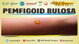 Pemfigoid Bulosa