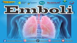 Emboli