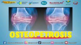Osteopetrosis