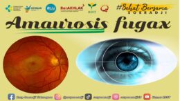Amaurosis Fugax
