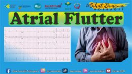 Atrial Flutter