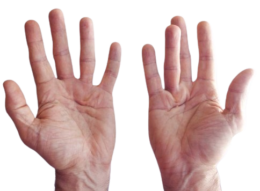 Arthritis Reumatoid Bukan Hanya Penyakit Tulang, Tapi Juga Penyakit Sistem Imun