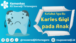 Ketahui Apa itu Karies Gigi pada Anak
